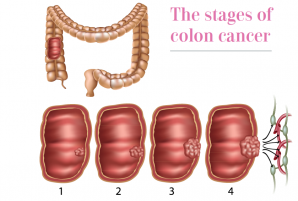 Colonoscopy Song For Colon Cancer Awareness