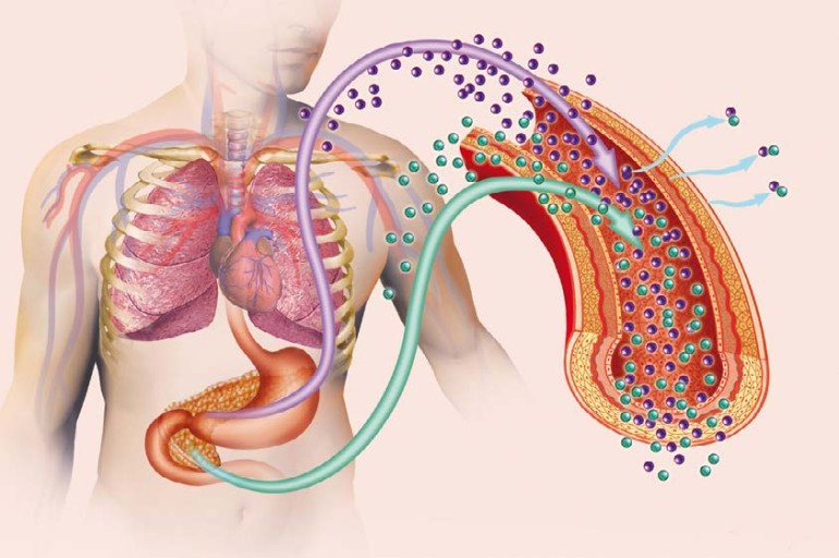 BRCA2 Gene Causes Pancreatic Cancer