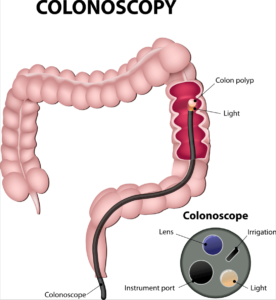 DrMache-colonoscopy