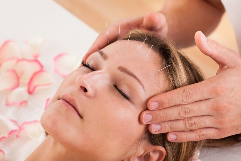 Acupuncture and Hot Flashes